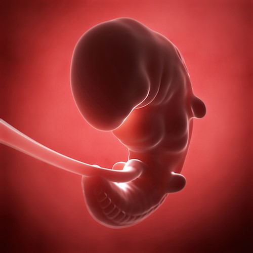 Hình ảnh siêu âm thai nhi 1 tháng tuổi 4